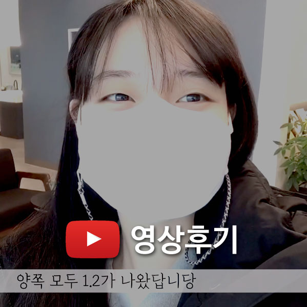 스마일 라식 후기
